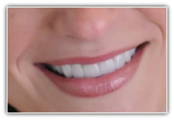 north spokane, dentist, near me, top dentist, family dentist, teeth whitening